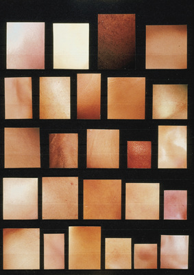 Patrick Van Caeckenbergh - Collection de peaux (Collection of Skins)