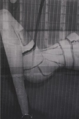 FERNWEH - Dirk Braeckman - S.W.-R.P.-20